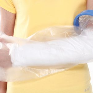 Protector para Yeso de Brazo